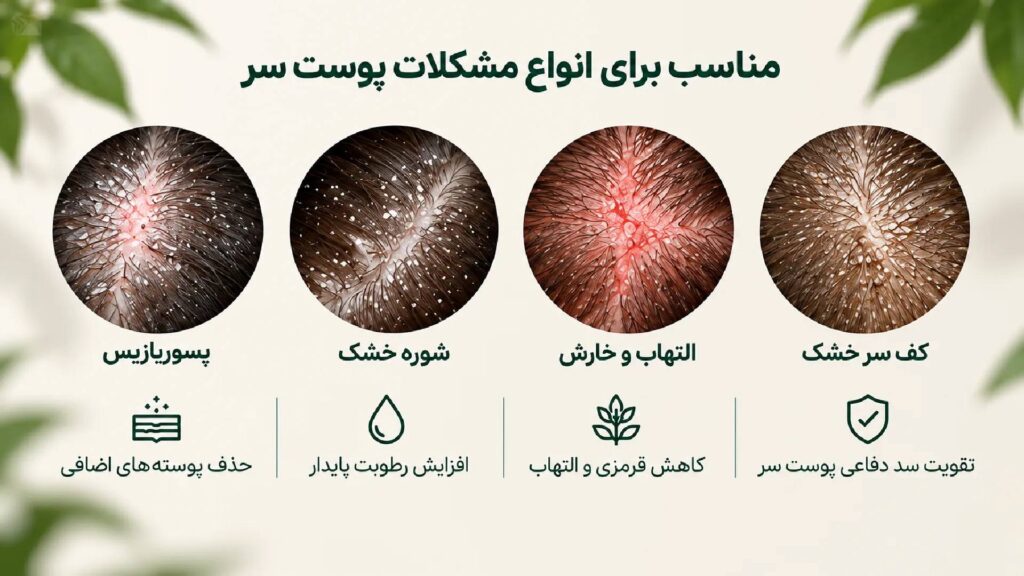 کاربردهای محلول آبرسان و پسوریازیس نووسلیکس