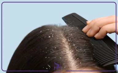 شوره خشک چیست و چرا به وجود می&zwnj; آید؟ | اسپا تجهیز